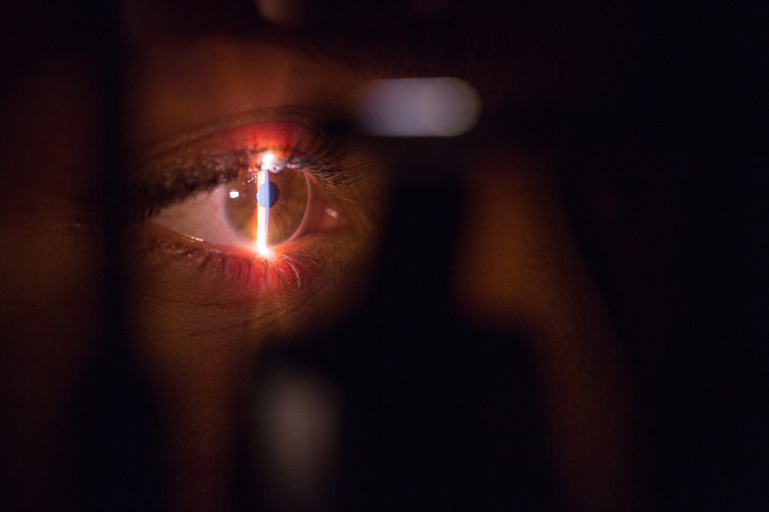 laser-ojo-techmedic